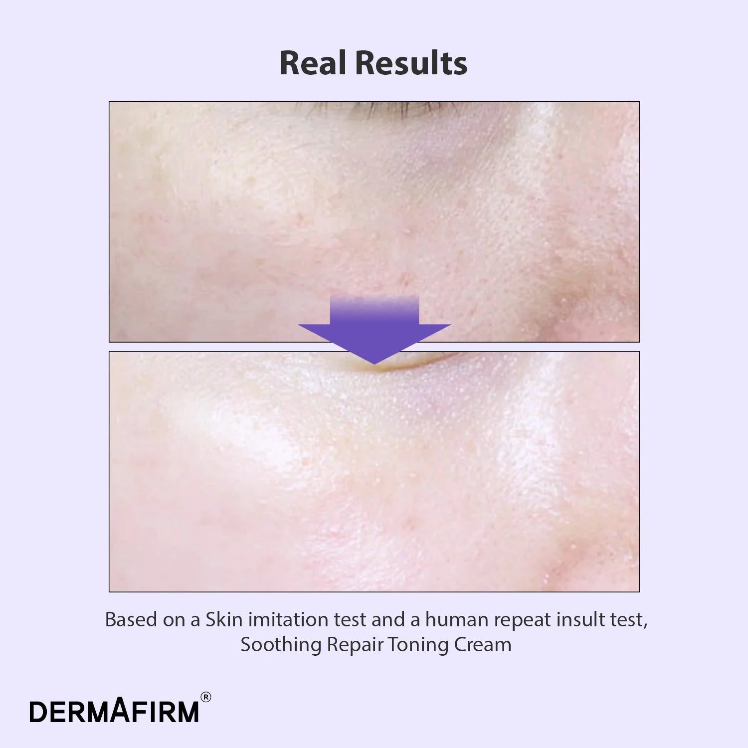 Soothing Repair Toning Cream R4