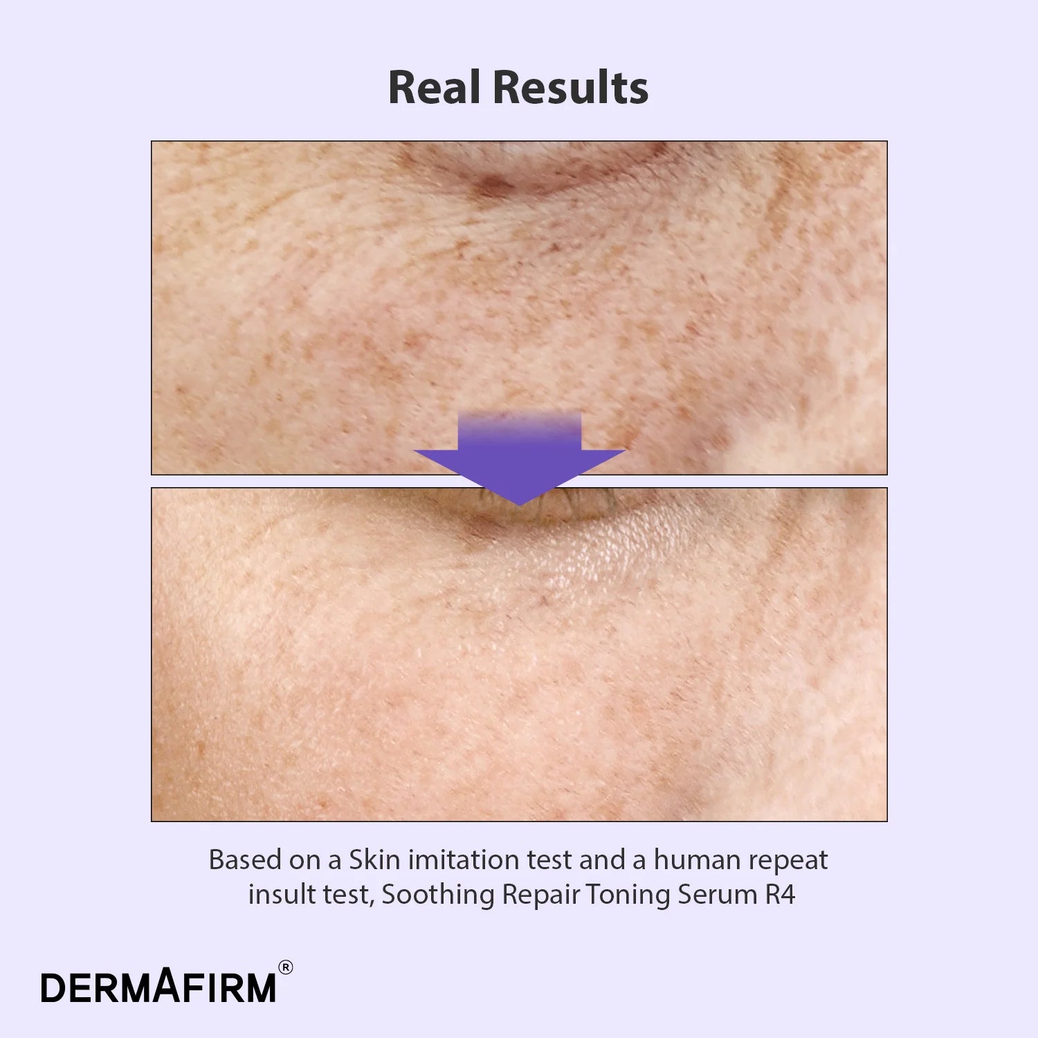 Soothing Repair Toning Serum R4