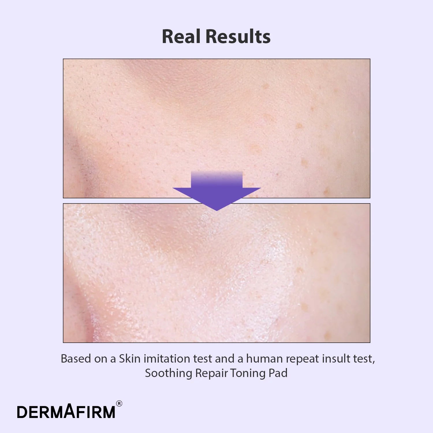 Soothing Repair Toning Pad R4