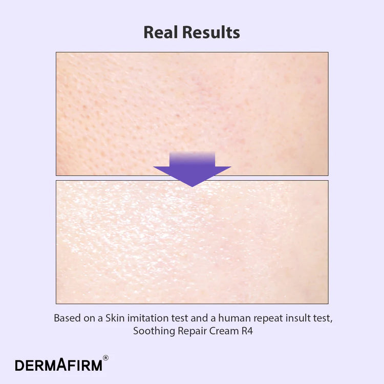 DERMAFIRM - Soothing Repair Cream R4